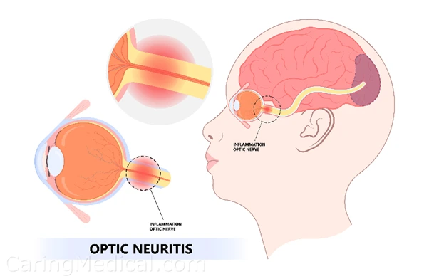 %EA%B7%B8%EB%A6%BC4.png?type=w966