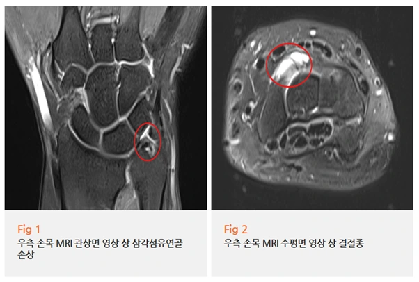 %EA%B7%B8%EB%A6%BC6.png?type=w966