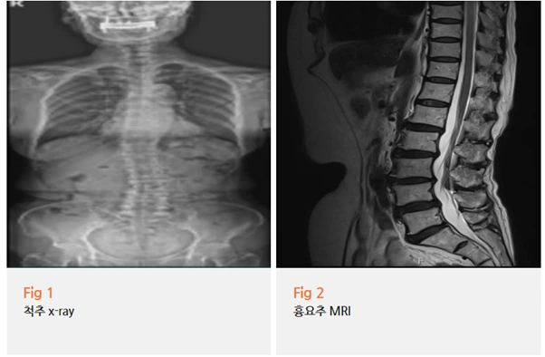 %EA%B7%B8%EB%A6%BC7.png?type=w966