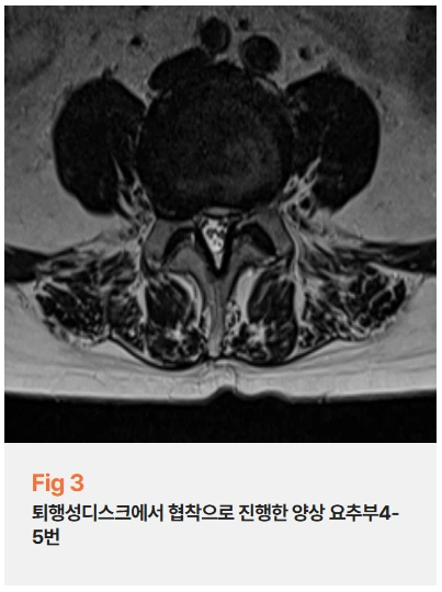 %EA%B7%B8%EB%A6%BC3.png?type=w966