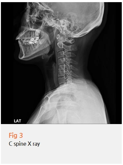 %EA%B7%B8%EB%A6%BC3.png?type=w966