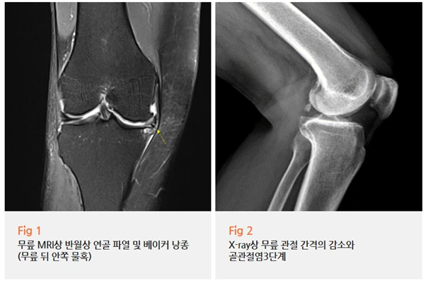 %EA%B7%B8%EB%A6%BC10.png?type=w966