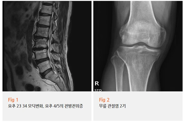 %EA%B7%B8%EB%A6%BC2.png?type=w966