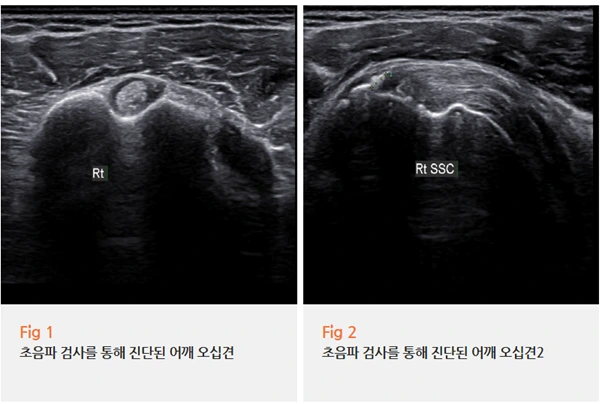 %EA%B7%B8%EB%A6%BC4.png?type=w966