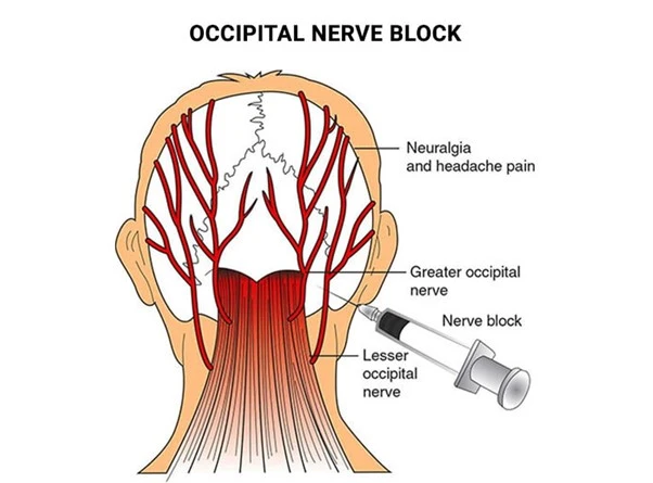 %EA%B7%B8%EB%A6%BC12.jpg?type=w966