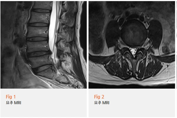 %EA%B7%B8%EB%A6%BC2.png?type=w966