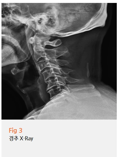 %EA%B7%B8%EB%A6%BC9.png?type=w966