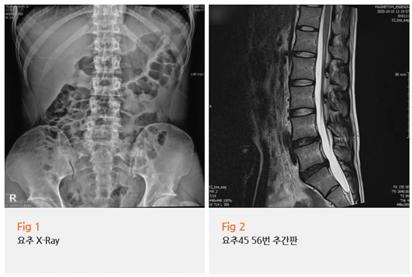 %EA%B7%B8%EB%A6%BC2.png?type=w966