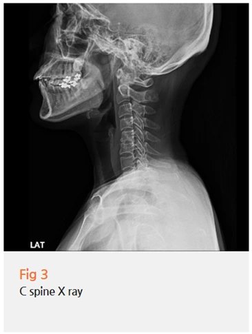 %EA%B7%B8%EB%A6%BC9.png?type=w966