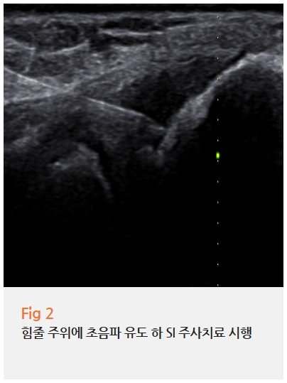 %EA%B7%B8%EB%A6%BC4.png?type=w966