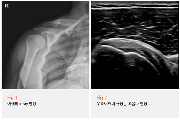 %EA%B7%B8%EB%A6%BC13.png?type=w966