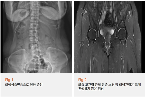 %EA%B7%B8%EB%A6%BC2.png?type=w966