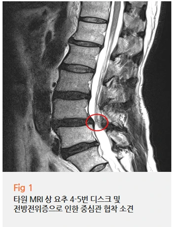 %EA%B7%B8%EB%A6%BC2.png?type=w966