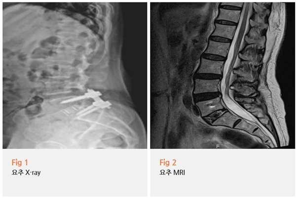 %EA%B7%B8%EB%A6%BC13.png?type=w966