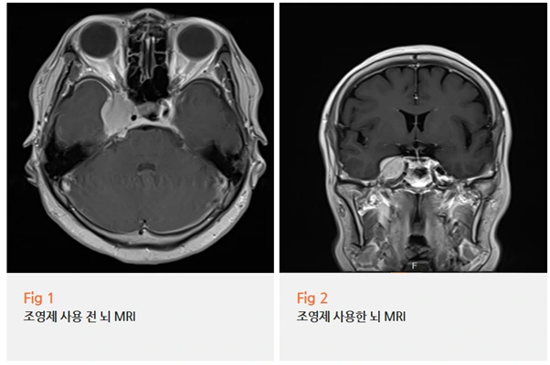 %EA%B7%B8%EB%A6%BC8.png?type=w966