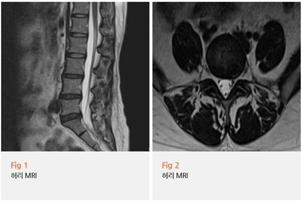 %EA%B7%B8%EB%A6%BC11.png?type=w966