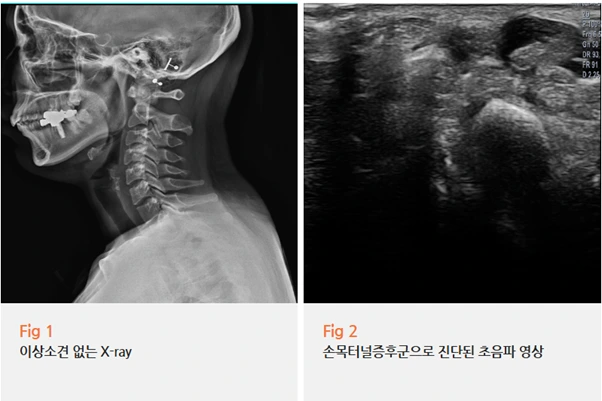 %EA%B7%B8%EB%A6%BC10.png?type=w966