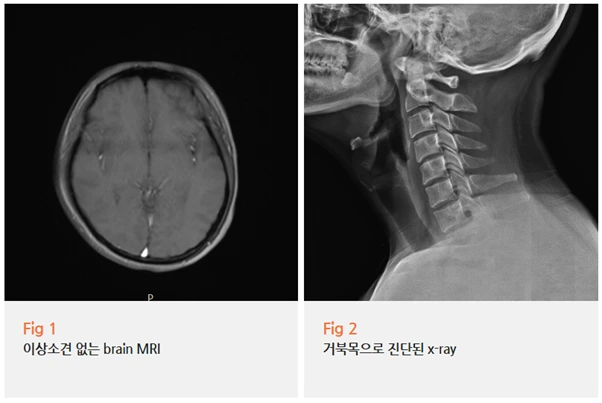 %EA%B7%B8%EB%A6%BC10.png?type=w966