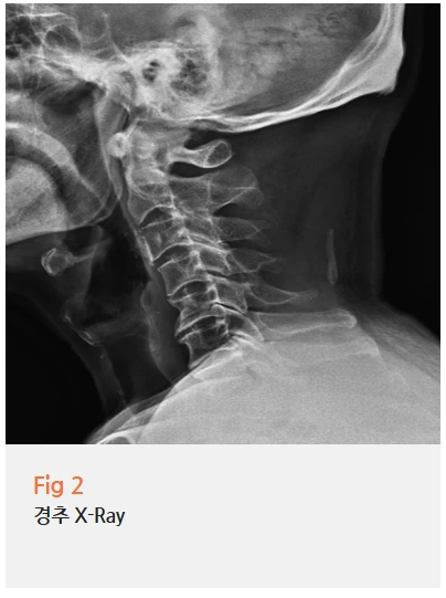 %EA%B7%B8%EB%A6%BC3.png?type=w966