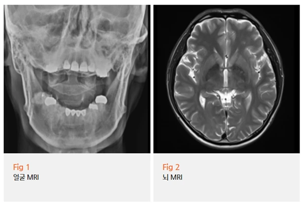 %EA%B7%B8%EB%A6%BC3.png?type=w966