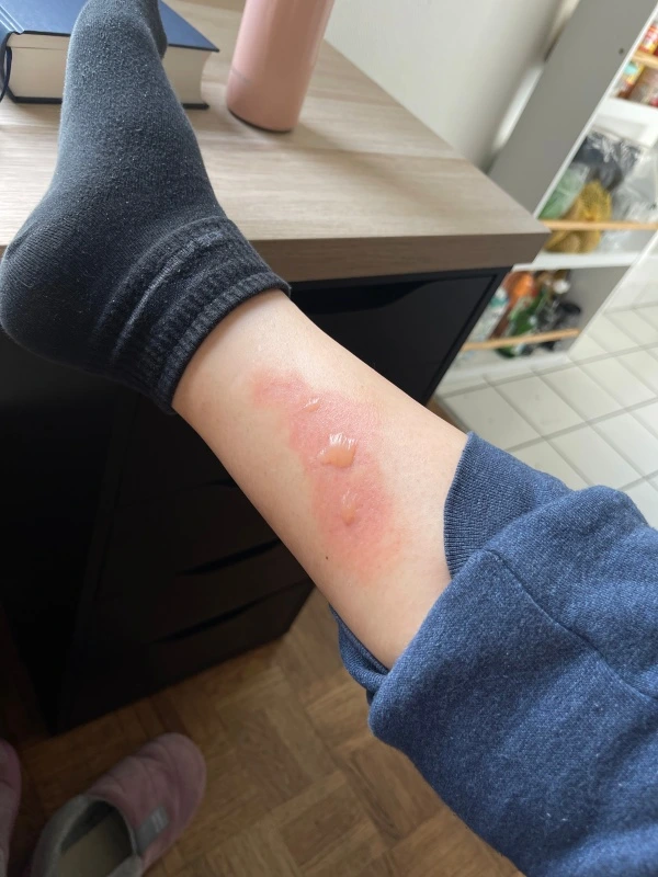 img.jpg?credential=yqXZFxpELC7KVnFOS48ylbz2pIh7yKj8&expires=1774969199&allow_ip=&allow_referer=&signature=rOqaynmlvxgfg8wqy1wlJU0B4s4%3D