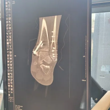 20250416_153934.jpg?type=w386