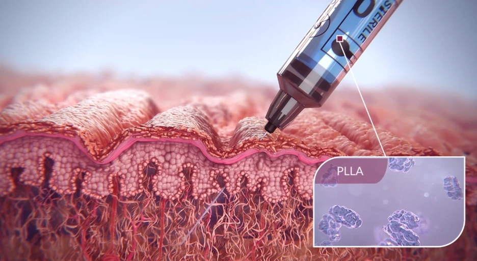 %EC%8A%A4%EC%BB%AC%ED%8A%B8%EB%9D%BC1.png?type=w1