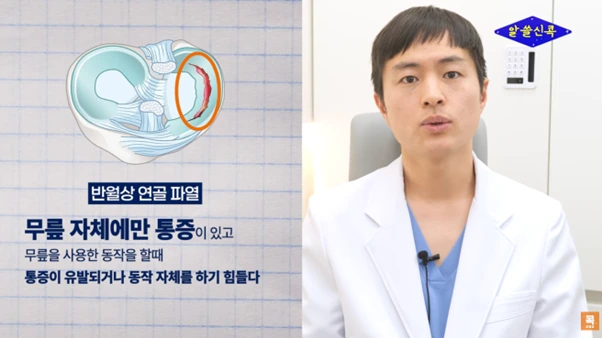 무릎 뒤 다리 오금 통증 때문에 병원 3군데 다녔는데