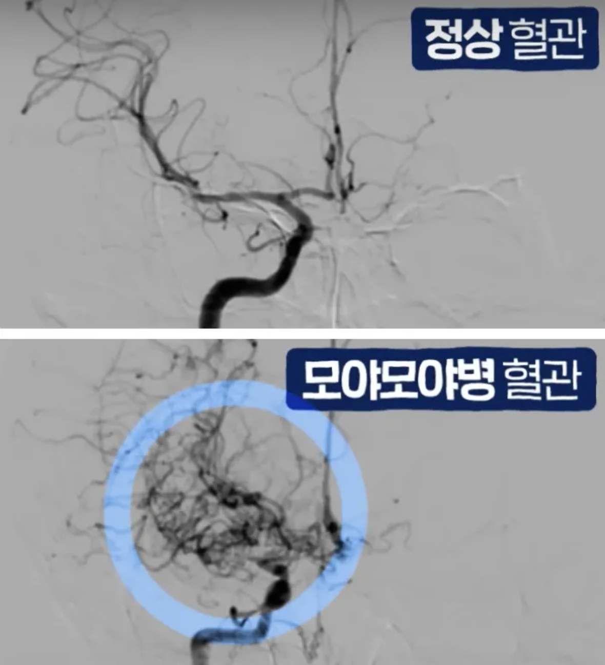 카지노 쿠폰