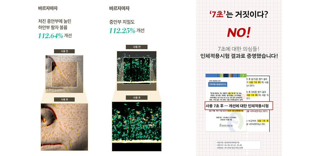 카지노 게임 사이트
