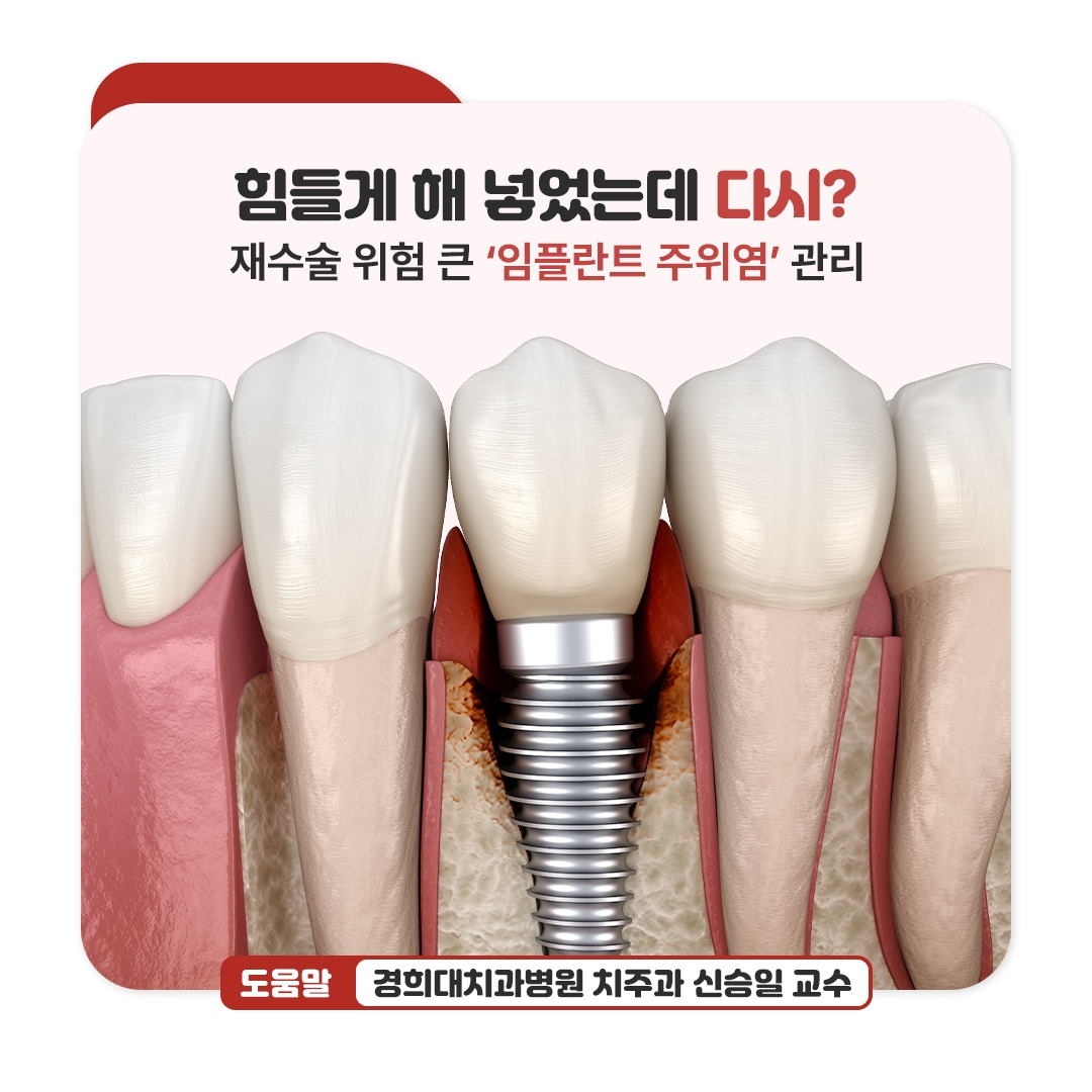 카지노 게임 사이트