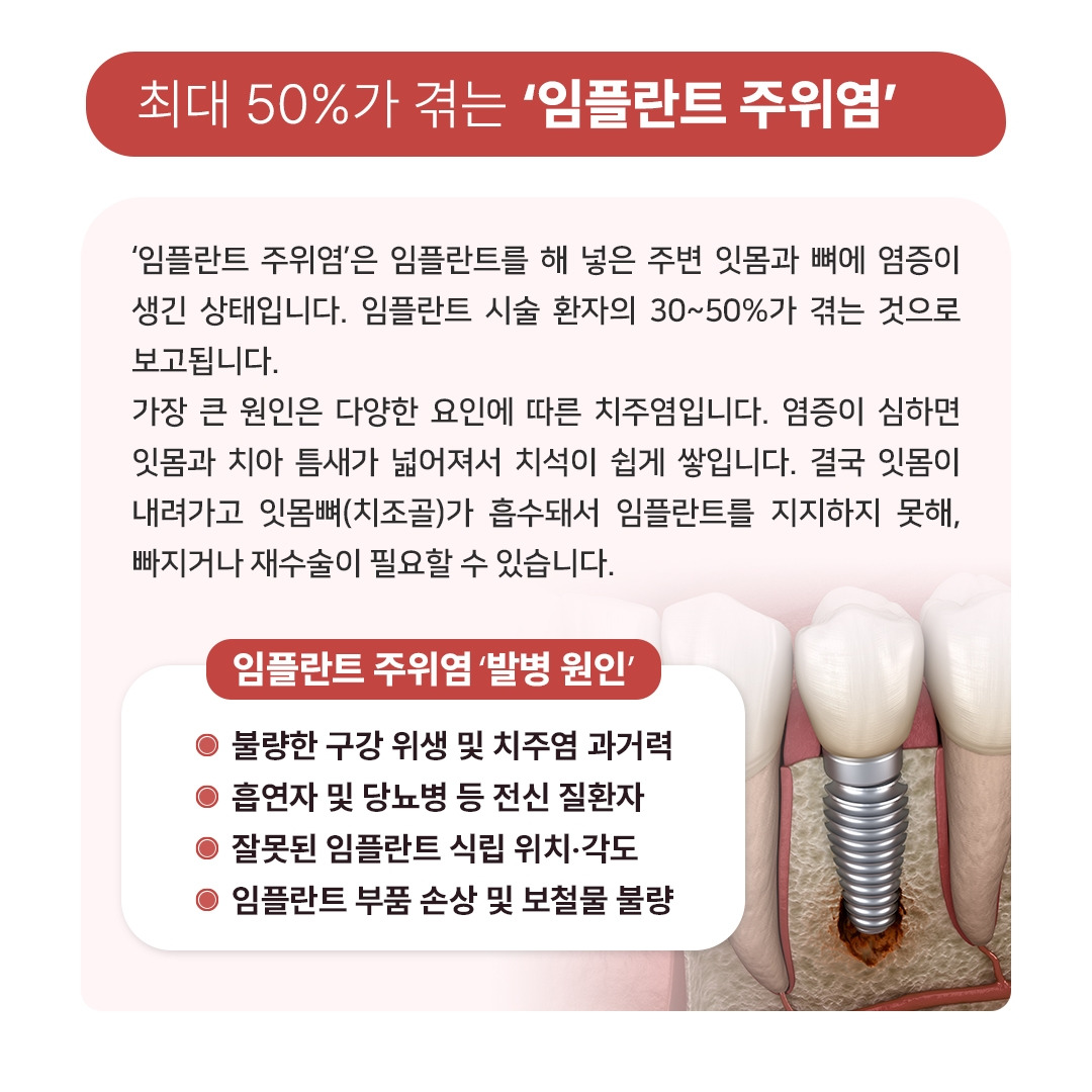 카지노 게임 사이트