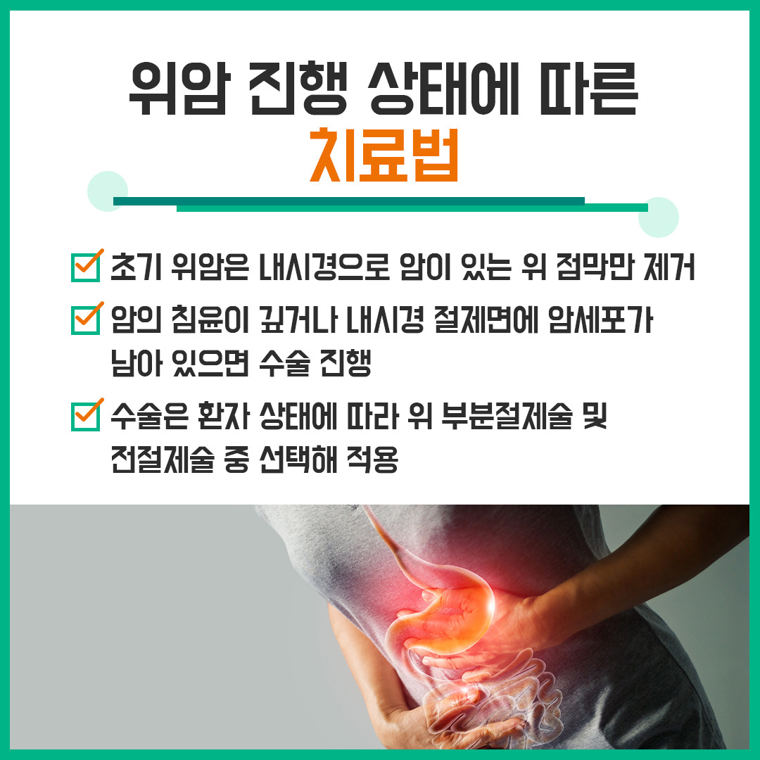 초기 증상 없는 '위암' 조기 진단 및 예방‧관리 방법