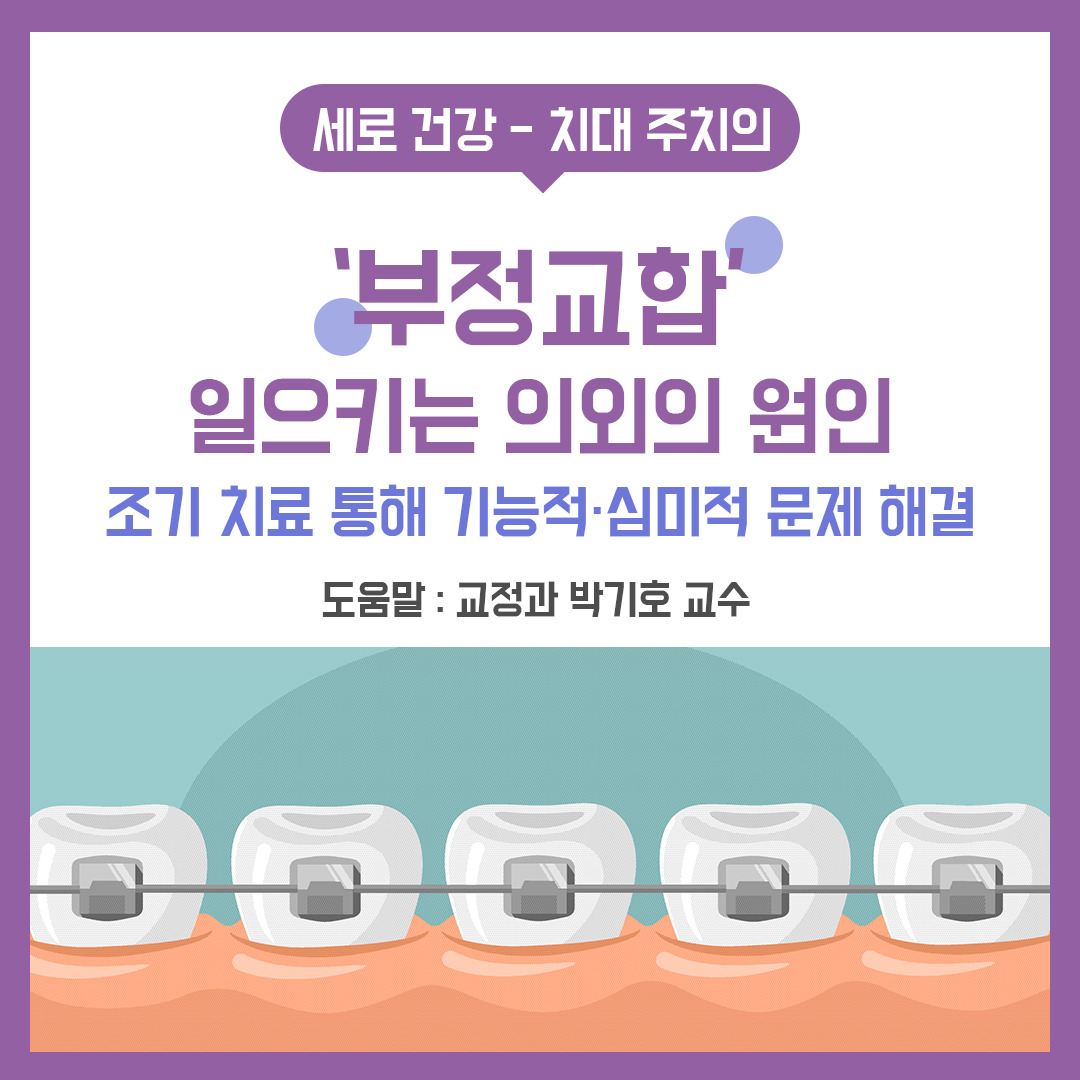 '부정교합' 일으키는 의외의 원인