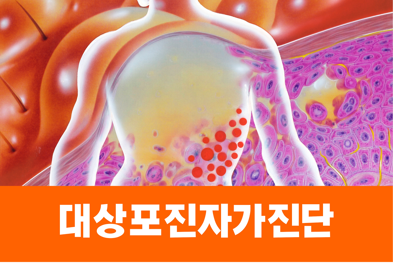 대상포진 자가진단 초기증상으로 알아보자