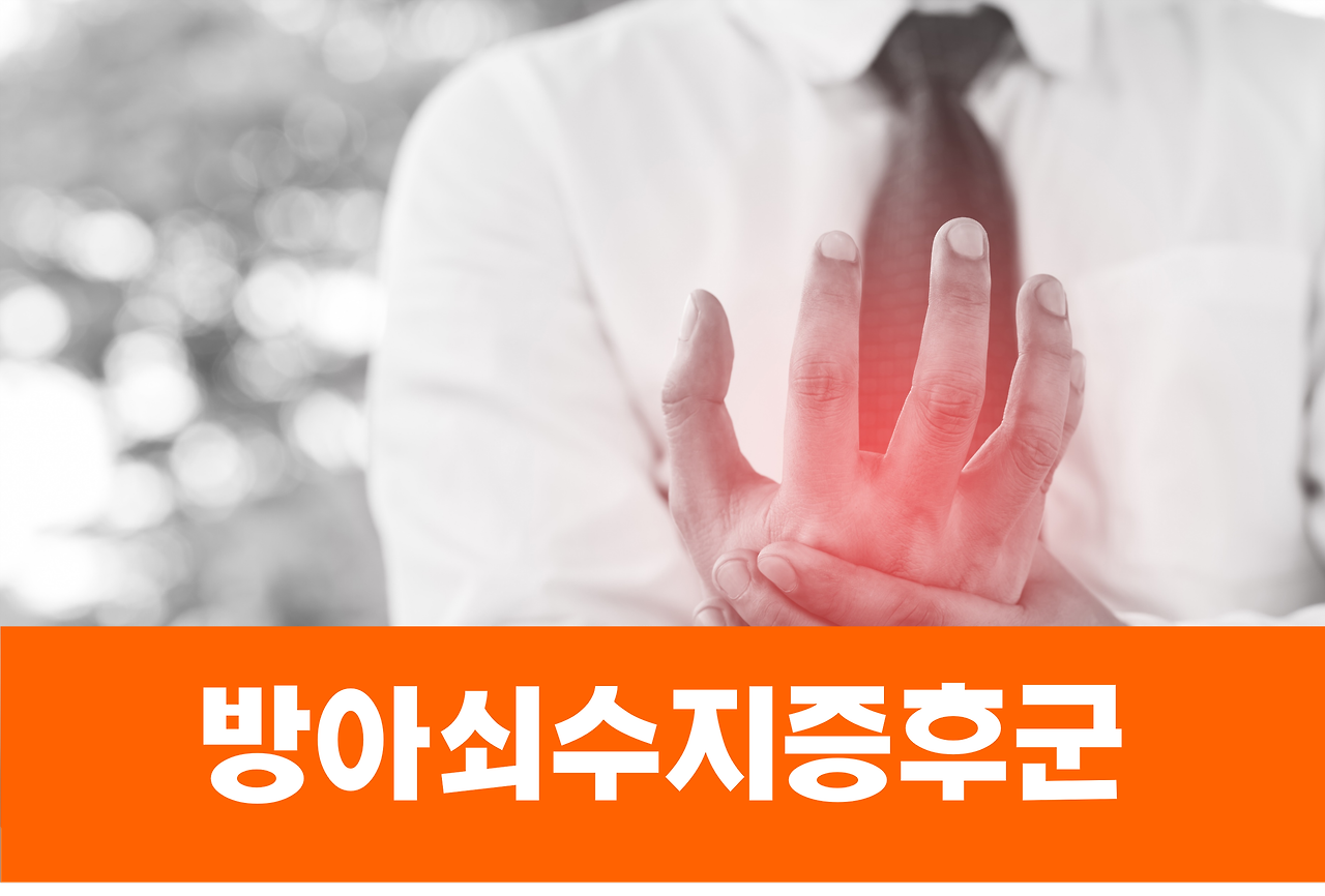 방아쇠수지증후군, 스마트폰 때문에 발생할 수도?