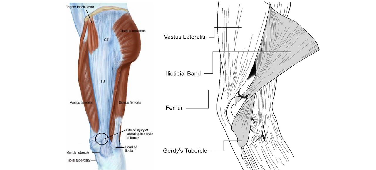 The Tensor Fascia Lata Muscle Flap