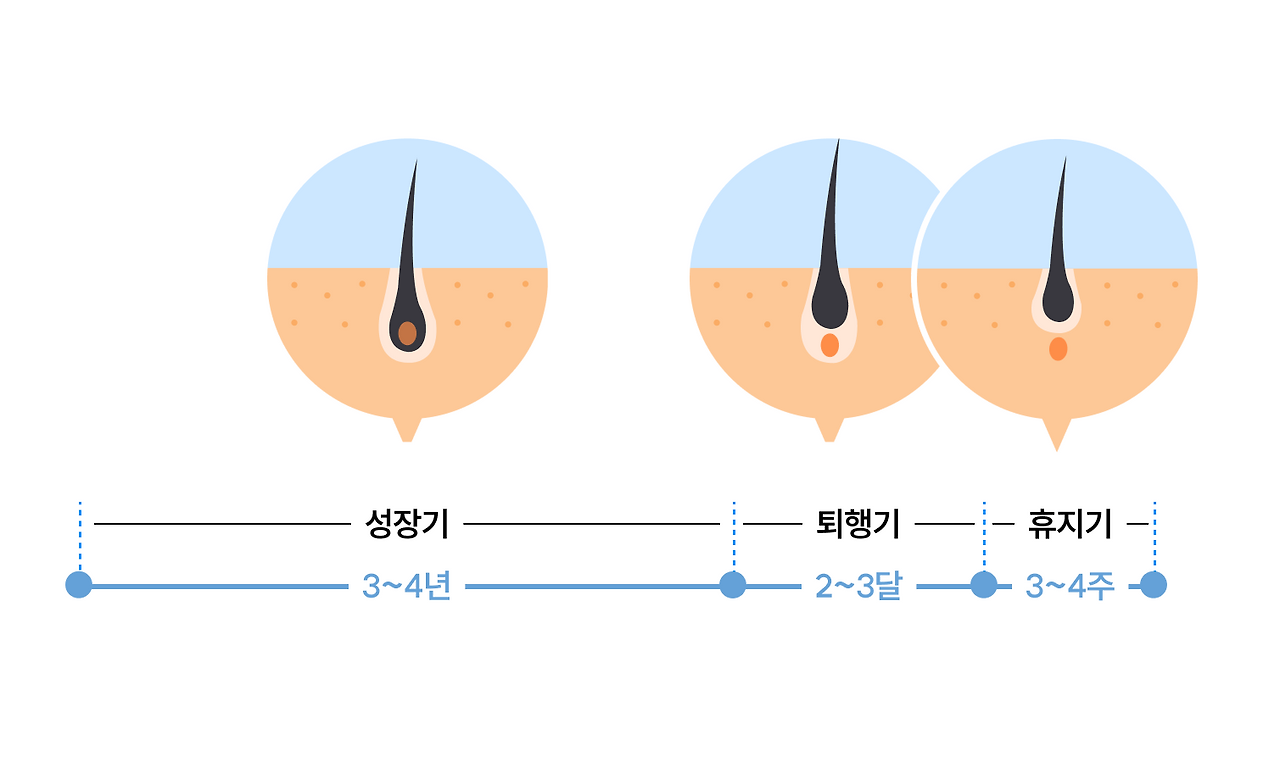 레이저 제모, 영구 제모가 가능할까?