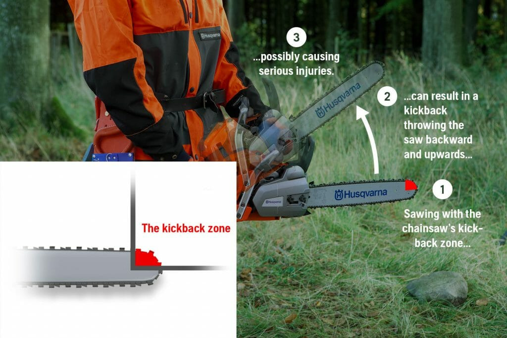 03화 킥백(Kickbacks) 현상