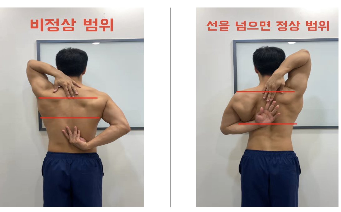 간단한 어깨 움직임 테스트를 통해 어깨 상태 알아보기