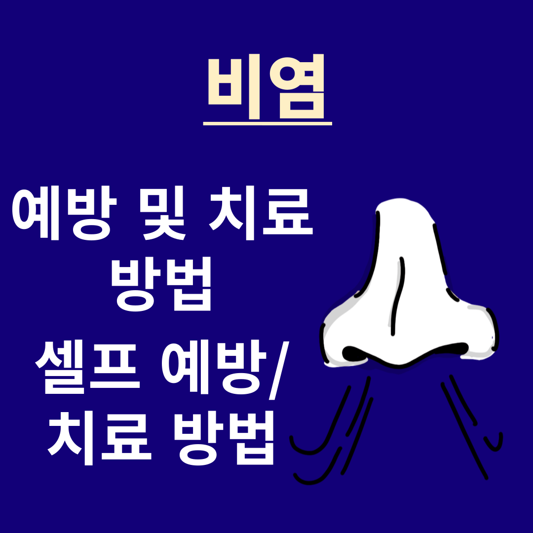 아로스 팝업