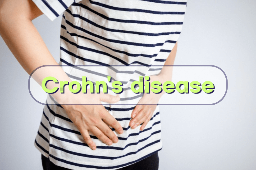 건강한 삶을 위한 크론병 슈퍼 가이드(Crohn's disease) 1 Crohn's disease