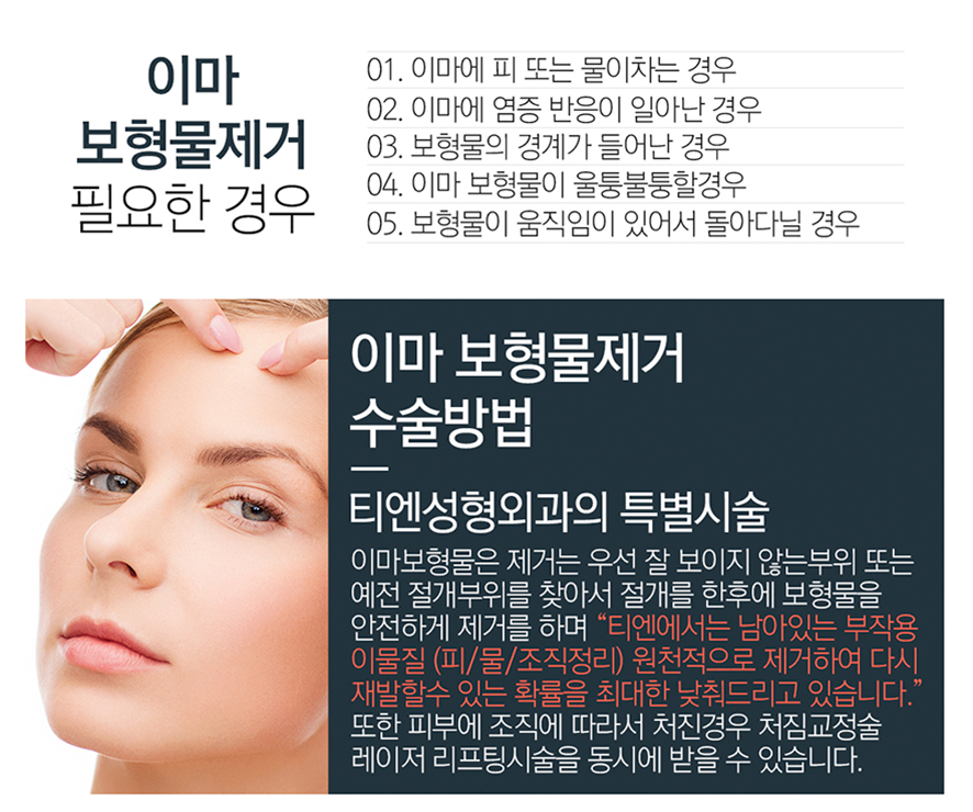 이마보형물 부작용 제거 비용 17년경력 합리적 가격정책