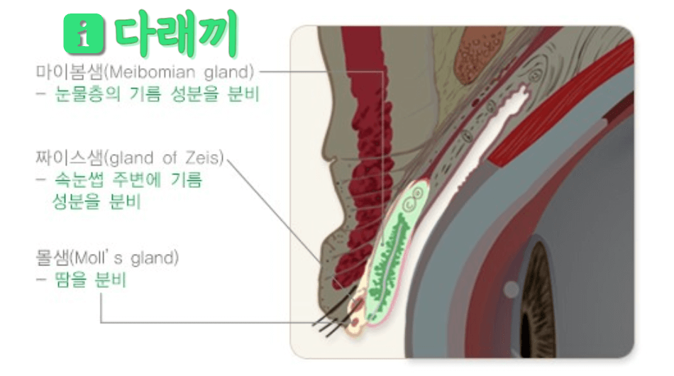 눈꺼풀 분비샘의 염증성 질환: 다래끼와 콩다래끼 1 ywAAAAAAQABAAACAUwAOw==