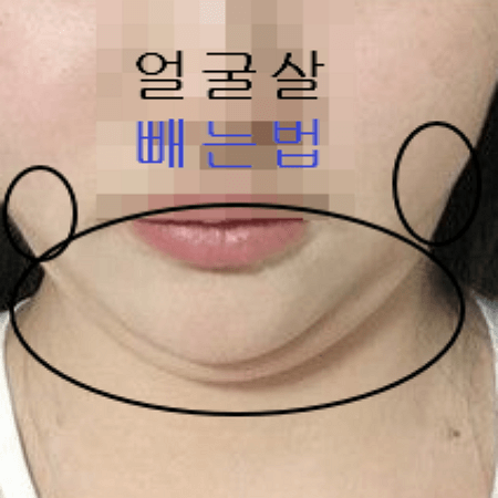 얼굴살 빼는법 3가지 ( 생활습관, 얼굴 지방흡입, 스트레칭 )