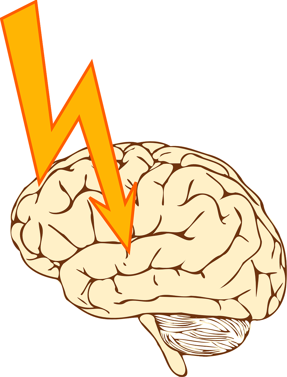 2-cerebral-hemorrhage