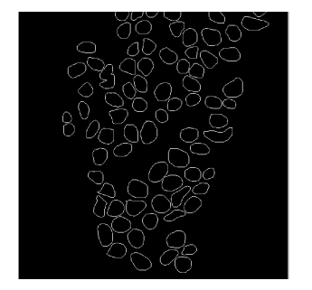 [MATLAB] OVERLAYING BINARY MASKS ON IMAGES IN MATLAB