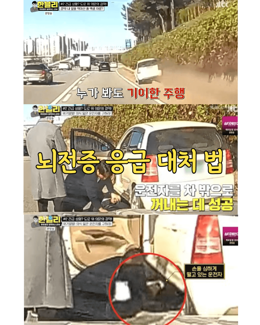 뇌전증 발작 증상 시 대처 방법 1 뇌전증대처