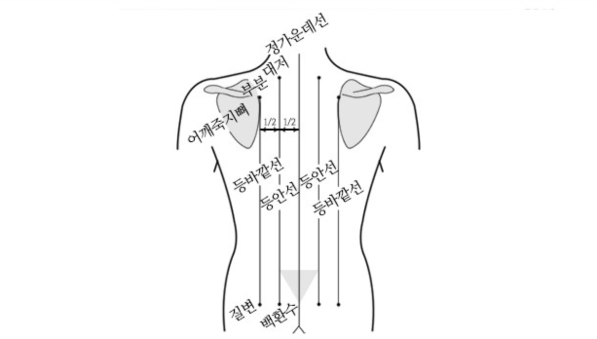 부항의 효능과 주의사항