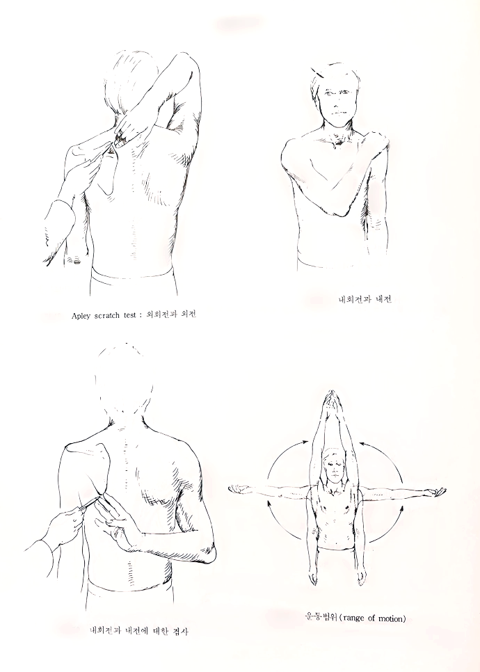 어깨 질환 오십견 Frozen Shoulder 오십견 원인 오십견증상 오십견치료방법 자가운동방법 정형외과적치료